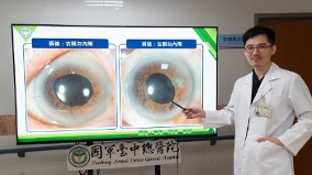 88歲男嚴重白內障近失明手術分段治療找回視力(圖)