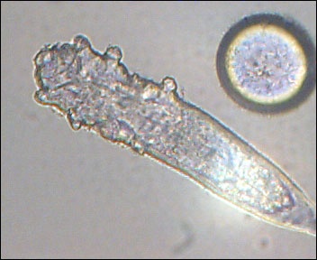 蠕形蟎蟲(Demodex),或稱毛囊蟎蟲、毛囊蟲。 編輯:twyishin 2026-07-11 16:16 圖片來源: 免费图片 (圖片來源:Haarbalgmilbe im Durchlichtmikroskop/維基百科)
