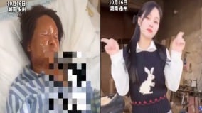 湖南31歲女主播收到炸彈包裹爆炸致面部毀容(組圖)