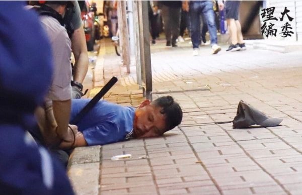 2019年10月31日，Tango被警察打成重傷。當時因為前面有很多手足正在撤離，政府文件顯示，當時一輛無標記的警察七人車以時速19至25公里（還在持續加速）直接衝向示威者人群後面，法庭上播放的車載攝像頭也證明了這一事實。他為了盡量拖延時間、讓手足有機會逃脫，衝出去擋在前面，結果被車上的飛虎隊成員暴打成重傷：先在警車上被打，下了車被拖進警署後繼續打。當晚23:15我被捕，我的私人律師當場已經無話可說，立即向警方提出要求驗傷，但警方故意謊稱我被關在另一個警署，導致律師直到第二天凌晨5點才找到我、行使法定權利。早上5:30律師已正式提出驗傷申請，然而警方卻拖到第二天（11月1日）晚上18:30才用救護車把我送去醫院驗傷。