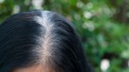 「白頭髮拔一根長十根」這個說法是真的嗎(組圖)