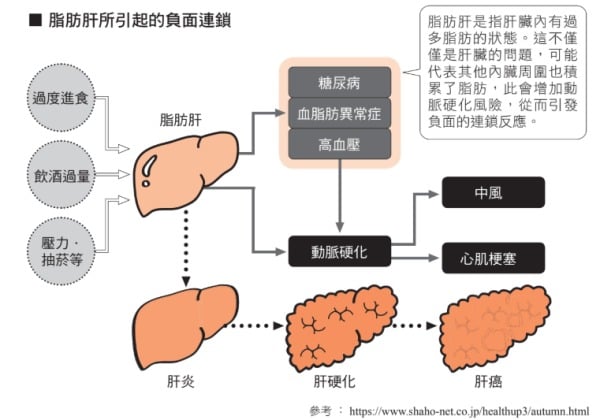 脂肪肝