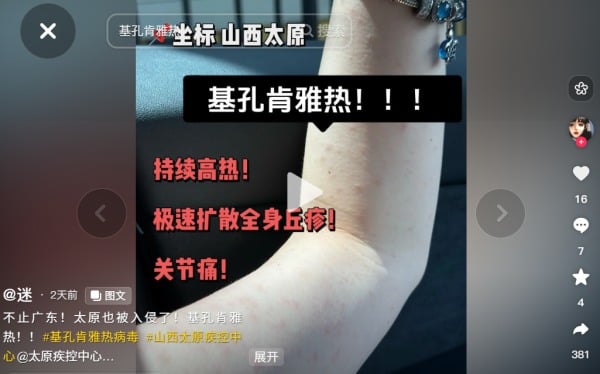 疫情