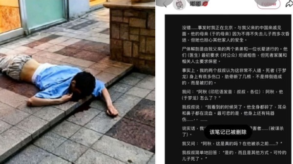 日前，一名網友披露了于朦朧屍檢報告的部分內容，法醫稱他是非正常死亡。