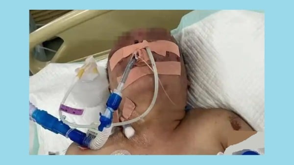辽宁盖州市43岁女子张丽萍遭前夫家暴身亡。