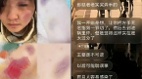 “拔指甲油炸手指”17岁女孩举报江西财大一男生(组图)