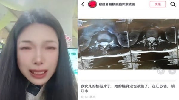 中国母亲控诉1年被撞4次母女俩脑脊液被偷上告无门(图)